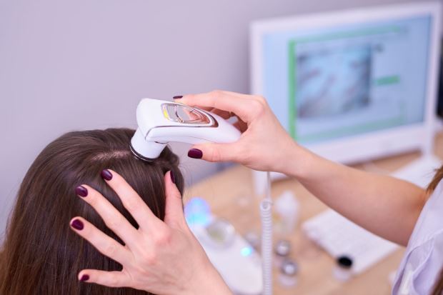 Scalp Micropigmentation