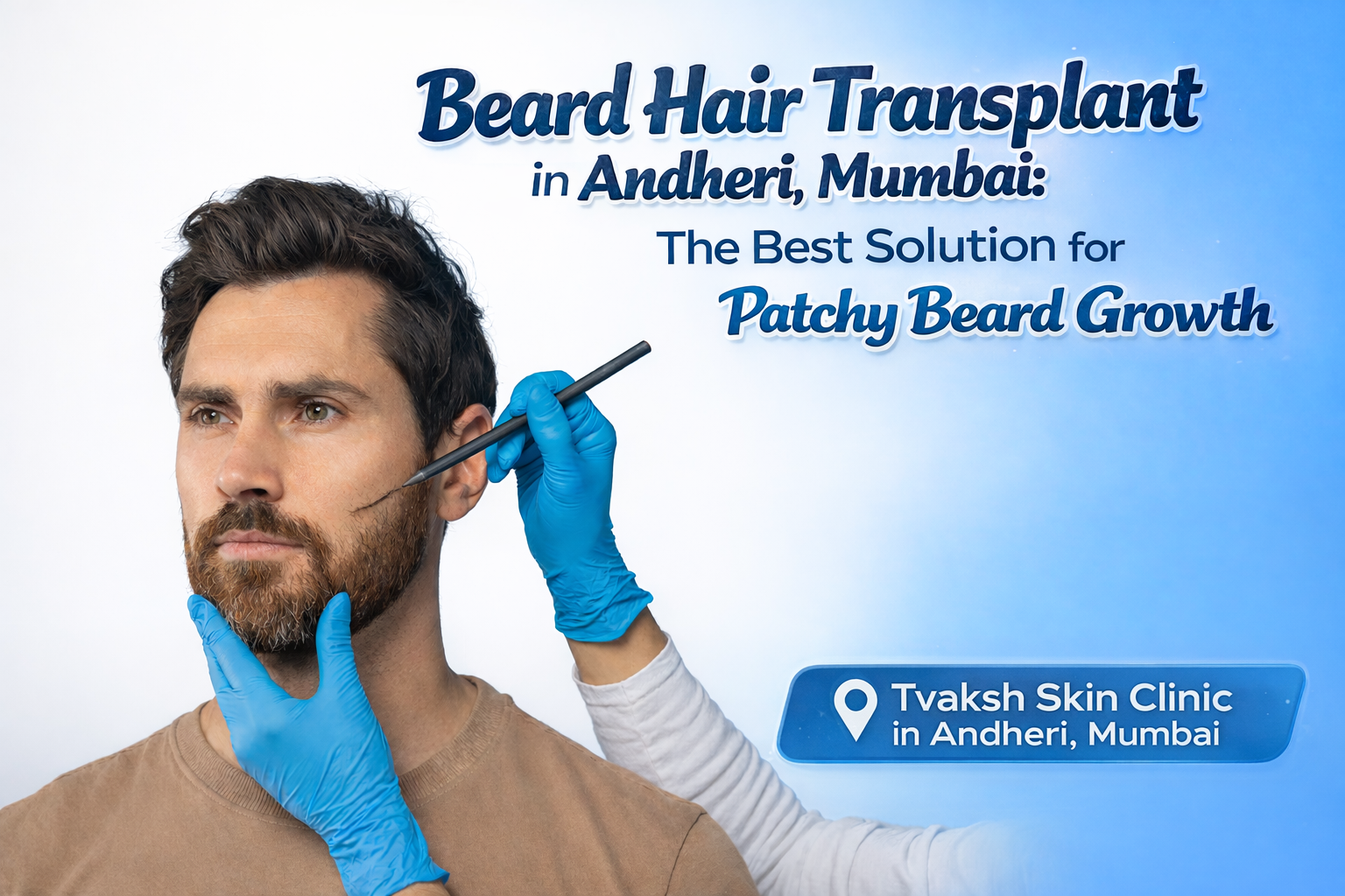 Beard Hair Transplant