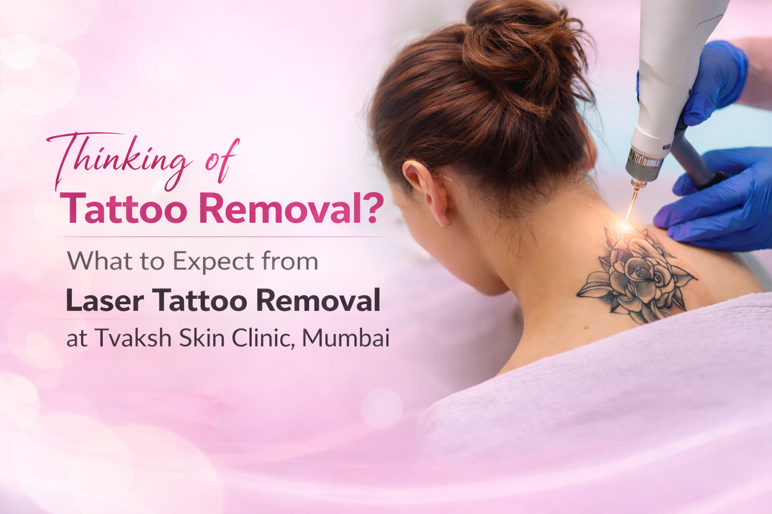 Laser Tattoo Removal Andheri