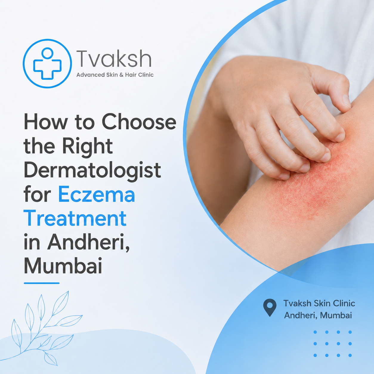 Eczema Treatment in Andheri