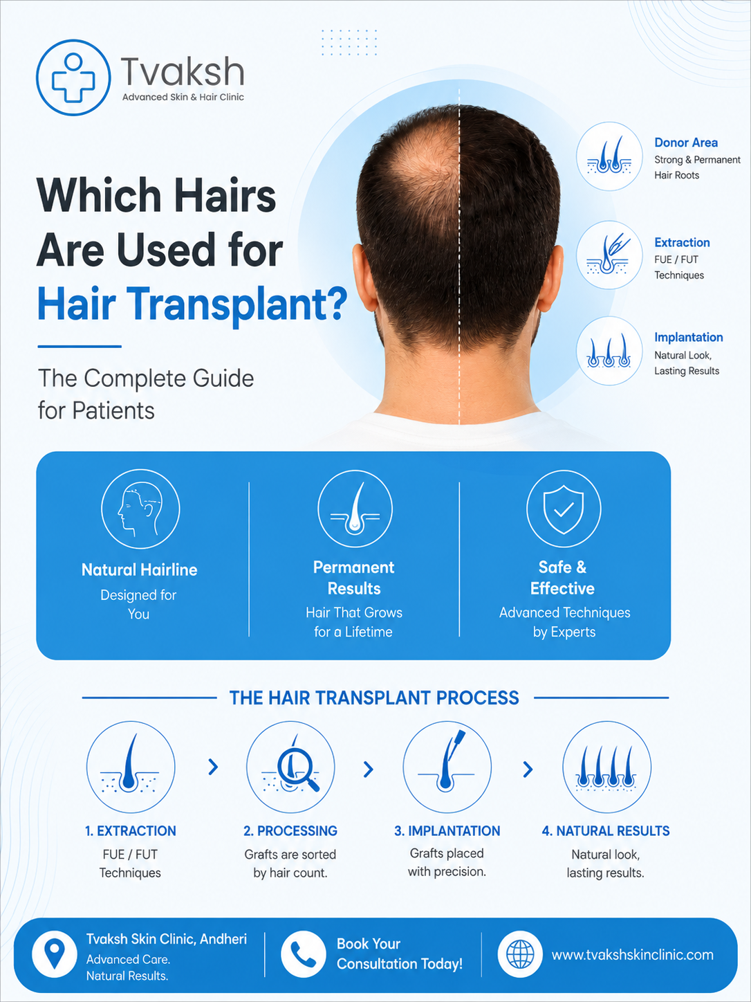 Hair Transplant Andheri