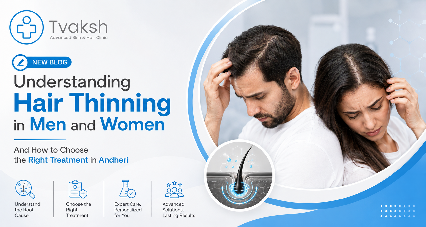 Hair Thinning Treatment in Andheri